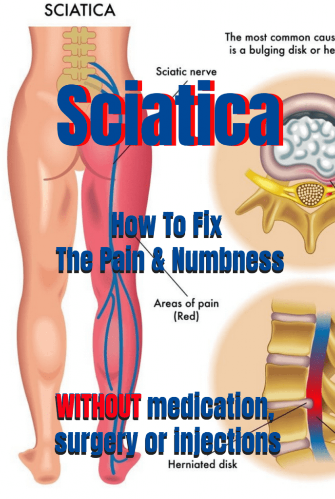How To fix the pain and numbness of Sciatica